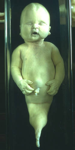 baby left